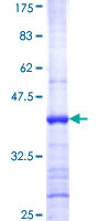 ATXN10 / SCA10 Protein - 12.5% SDS-PAGE Stained with Coomassie Blue.