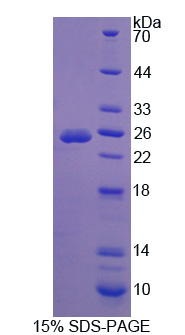 ATXN10 / SCA10 Protein - Recombinant Ataxin 10 By SDS-PAGE