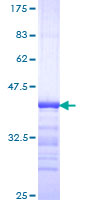 ATXN2 / SCA2 / Ataxin-2 Protein - 12.5% SDS-PAGE Stained with Coomassie Blue.