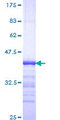 ATXN2 / SCA2 / Ataxin-2 Protein - 12.5% SDS-PAGE Stained with Coomassie Blue.