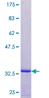 ATXN3 / JOS Protein - 12.5% SDS-PAGE of human ATXN3 stained with Coomassie Blue