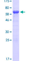 ATXN3 / JOS Protein - 12.5% SDS-PAGE of human ATXN3 stained with Coomassie Blue