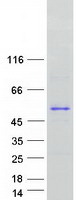 ATXN3 / JOS Protein - Purified recombinant protein ATXN3 was analyzed by SDS-PAGE gel and Coomassie Blue Staining
