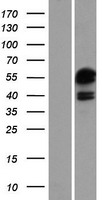 ATXN7L3 Protein - Western validation with an anti-DDK antibody * L: Control HEK293 lysate R: Over-expression lysate
