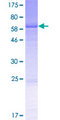 AUP1 Protein - 12.5% SDS-PAGE of human AUP1 stained with Coomassie Blue