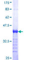 AURKA / Aurora-A Protein - 12.5% SDS-PAGE Stained with Coomassie Blue.