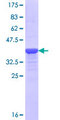 AURKA / Aurora-A Protein - 12.5% SDS-PAGE Stained with Coomassie Blue.