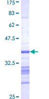 AURKB / Aurora-B Protein - 12.5% SDS-PAGE Stained with Coomassie Blue.