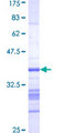 AURKB / Aurora-B Protein - 12.5% SDS-PAGE Stained with Coomassie Blue.