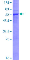 AURKC / Aurora C Protein - 12.5% SDS-PAGE of human AURKC stained with Coomassie Blue