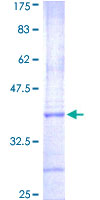 AURKC / Aurora C Protein - 12.5% SDS-PAGE Stained with Coomassie Blue.