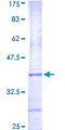 AURKC / Aurora C Protein - 12.5% SDS-PAGE Stained with Coomassie Blue.