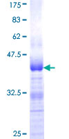 AUTS2 Protein - 12.5% SDS-PAGE Stained with Coomassie Blue.