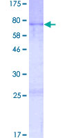 AVEN / PDCD12 Protein - 12.5% SDS-PAGE of human AVEN stained with Coomassie Blue