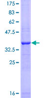 AVIL / Advillin Protein - 12.5% SDS-PAGE Stained with Coomassie Blue.