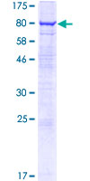 AVL9 Protein - 12.5% SDS-PAGE of human KIAA0241 stained with Coomassie Blue