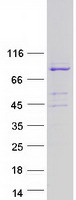AVL9 Protein - Purified recombinant protein AVL9 was analyzed by SDS-PAGE gel and Coomassie Blue Staining