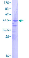 AVPI1 Protein - 12.5% SDS-PAGE of human AVPI1 stained with Coomassie Blue