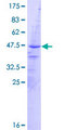 AVPI1 Protein - 12.5% SDS-PAGE of human AVPI1 stained with Coomassie Blue