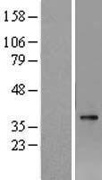 AWAT1 / DGAT2L3 Protein - Western validation with an anti-DDK antibody * L: Control HEK293 lysate R: Over-expression lysate