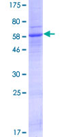 AWAT1 / DGAT2L3 Protein - 12.5% SDS-PAGE of human DGAT2L3 stained with Coomassie Blue