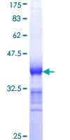 AXIN1 / Axin-1 Protein - 12.5% SDS-PAGE Stained with Coomassie Blue.