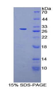 AXIN1 / Axin-1 Protein - Recombinant Axis Inhibition Protein By SDS-PAGE