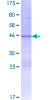 AXIN2 / Axin 2 Protein - 12.5% SDS-PAGE of human AXIN2 stained with Coomassie Blue