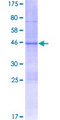 AXIN2 / Axin 2 Protein - 12.5% SDS-PAGE of human AXIN2 stained with Coomassie Blue