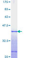 AXIN2 / Axin 2 Protein - 12.5% SDS-PAGE Stained with Coomassie Blue.