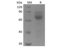 AXL Protein - Recombinant Human Tyrosine-protein kinase receptor UFO/AXL oncogene/UFO (C-6His)