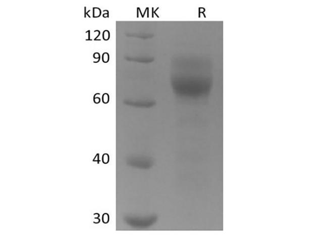 AXL Protein - Recombinant Human Tyrosine-protein kinase receptor UFO/AXL oncogene/UFO (C-6His)