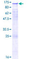 AXL Protein - 12.5% SDS-PAGE of human AXL stained with Coomassie Blue