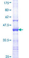 AXL Protein - 12.5% SDS-PAGE Stained with Coomassie Blue.