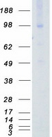 AXL Protein - Purified recombinant protein AXL was analyzed by SDS-PAGE gel and Coomassie Blue Staining