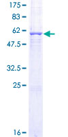 AZGP1 / ZAG Protein - 12.5% SDS-PAGE of human AZGP1 stained with Coomassie Blue