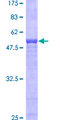 AZGP1 / ZAG Protein - 12.5% SDS-PAGE of human AZGP1 stained with Coomassie Blue