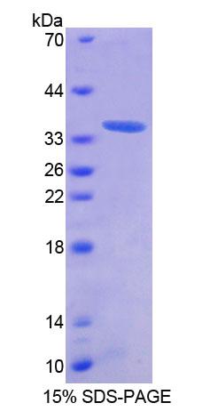 AZIN1 Protein - Recombinant  Antizyme Inhibitor 1 By SDS-PAGE