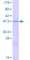 AZU1 / Azurocidin Protein - 12.5% SDS-PAGE of human AZU1 stained with Coomassie Blue