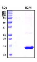 B2M / Beta 2 Microglobulin Protein - SDS-PAGE under reducing conditions and visualized by Coomassie blue staining