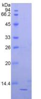 B2M / Beta 2 Microglobulin Protein - Recombinant Beta-2-Microglobulin By SDS-PAGE