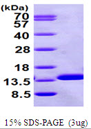 B2M / Beta 2 Microglobulin Protein