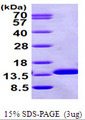 B2M / Beta 2 Microglobulin Protein