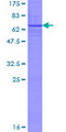 B3GALNT1 Protein - 12.5% SDS-PAGE of human B3GALT3 stained with Coomassie Blue