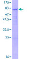 B3GALNT2 Protein - 12.5% SDS-PAGE of human B3GALNT2 stained with Coomassie Blue