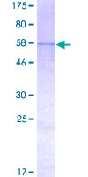 B3GALT1 Protein - 12.5% SDS-PAGE of human B3GALT1 stained with Coomassie Blue