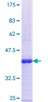 B3GALT1 Protein - 12.5% SDS-PAGE Stained with Coomassie Blue.