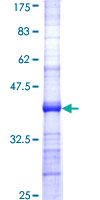 B3GALT5 Protein - 12.5% SDS-PAGE Stained with Coomassie Blue.
