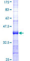 B3GALT5 Protein - 12.5% SDS-PAGE Stained with Coomassie Blue.