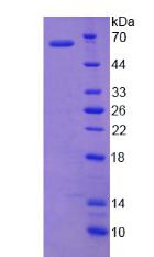 B3GALT5 Protein - Recombinant Beta-1,3-Galactosyltransferase 5 By SDS-PAGE